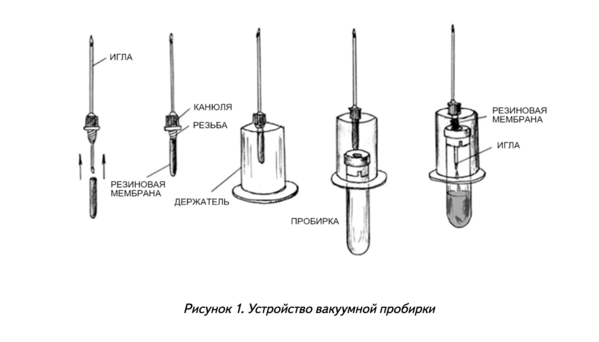 Үлкен қара әтештері бар анал