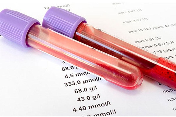 Түкті пабтардың эротикалық бейнесі Үй иесі мен құлдың BDSM сценарийлері