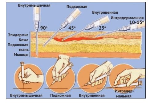 Спорттағы кездейсоқ эротика